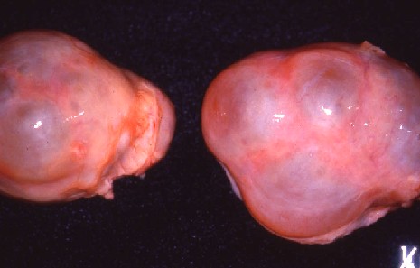牛の卵胞嚢腫