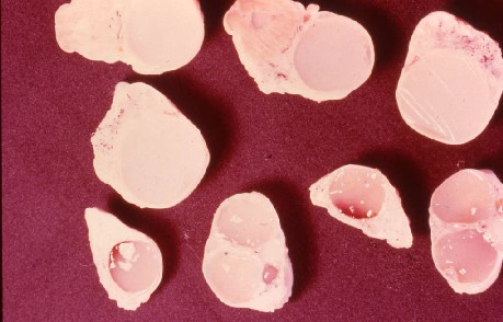 牛の卵胞嚢腫