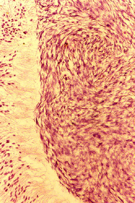 牛の精巣上体内で精子の成熟と精子を搬送する線毛上皮