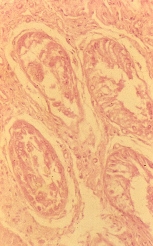 無精子症を発した牛の精細管組織像