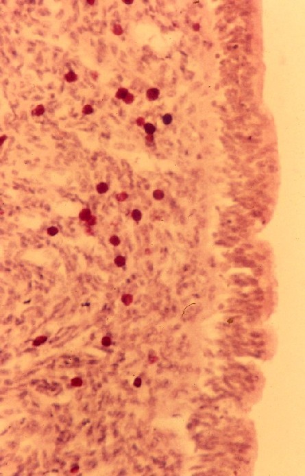 牛子宮組織の肥満細胞(Mast cell)