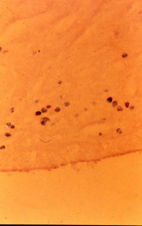 牛子宮組織の肥満細胞(Mast cell)