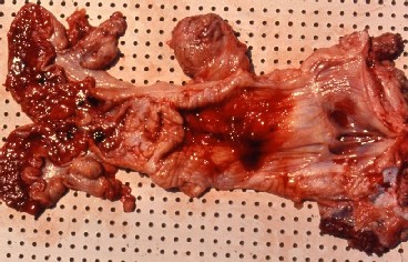 排卵後の牛の子宮出血
