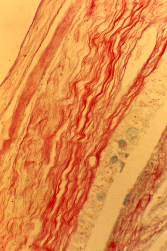 膠原繊維染色した分娩直後の羊膜(牛)