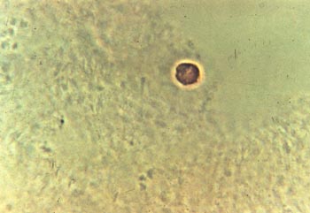ハムスターの卵子内に入ったカモシカ精子の写真
