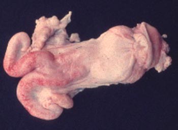排卵後の子宮