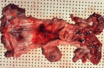 排卵後の子宮の内部