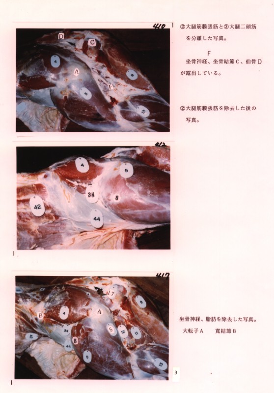 大腿筋膜張筋の分離他