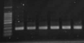 RT-PCRで得られた産物の泳動写真