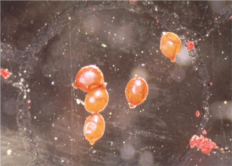 ダイズシストセンチュウ形態3