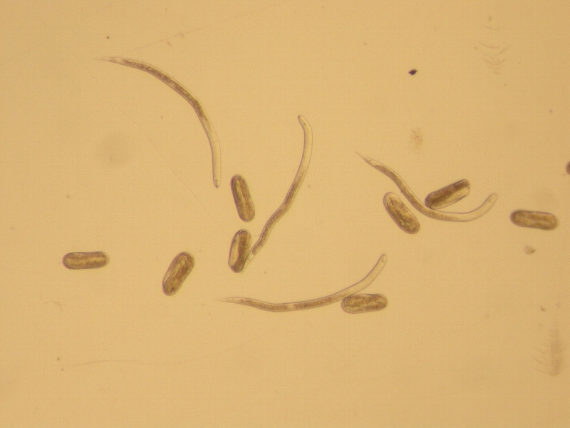 ダイズシストセンチュウ形態4