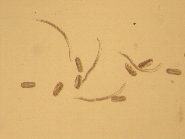 ダイズシストセンチュウ形態4