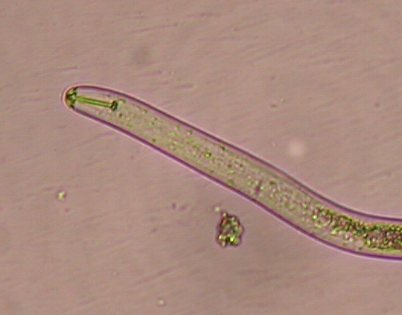 ダイズシストセンチュウ形態5