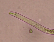 ダイズシストセンチュウ形態5