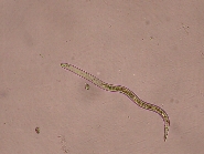 ダイズシストセンチュウ形態6