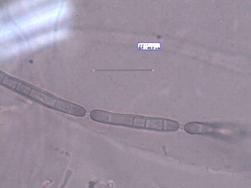 ダイズ褐色輪紋病の病原2