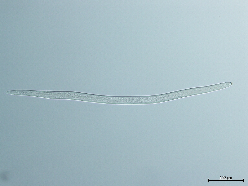 キタネグサレセンチュウの雌成虫