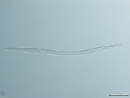 キタネグサレセンチュウの雌成虫