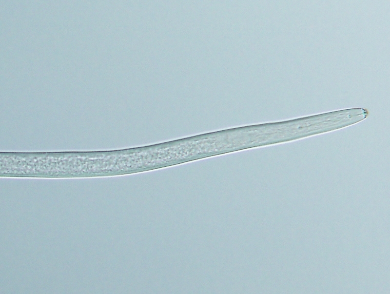 キタネグサレセンチュウの雌成虫