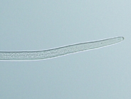 キタネグサレセンチュウの雌成虫