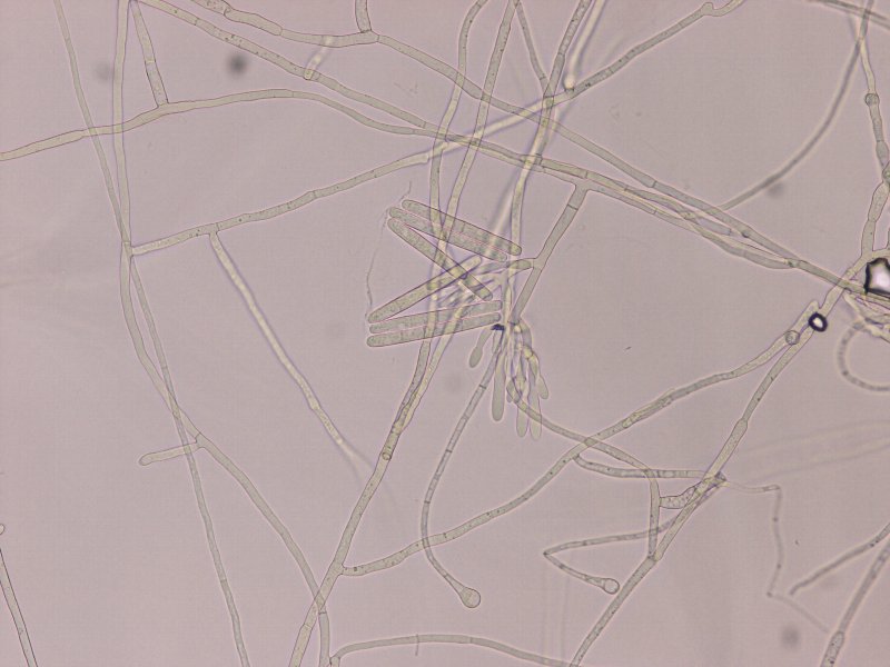 分生胞子とvesicle
