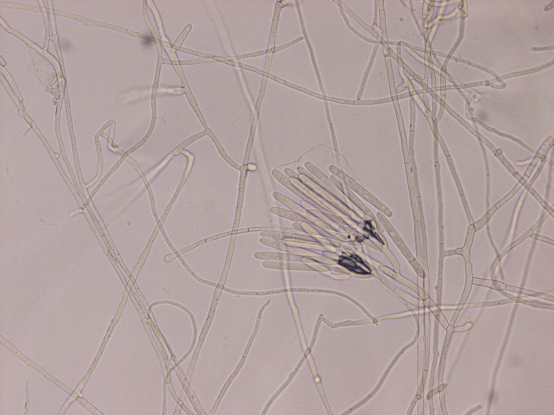 分生胞子とvesicle