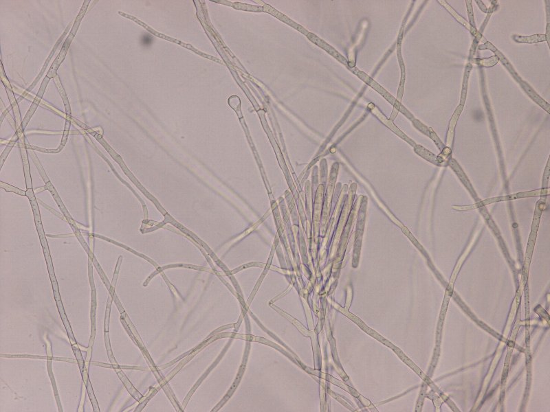 分生胞子とvesicle