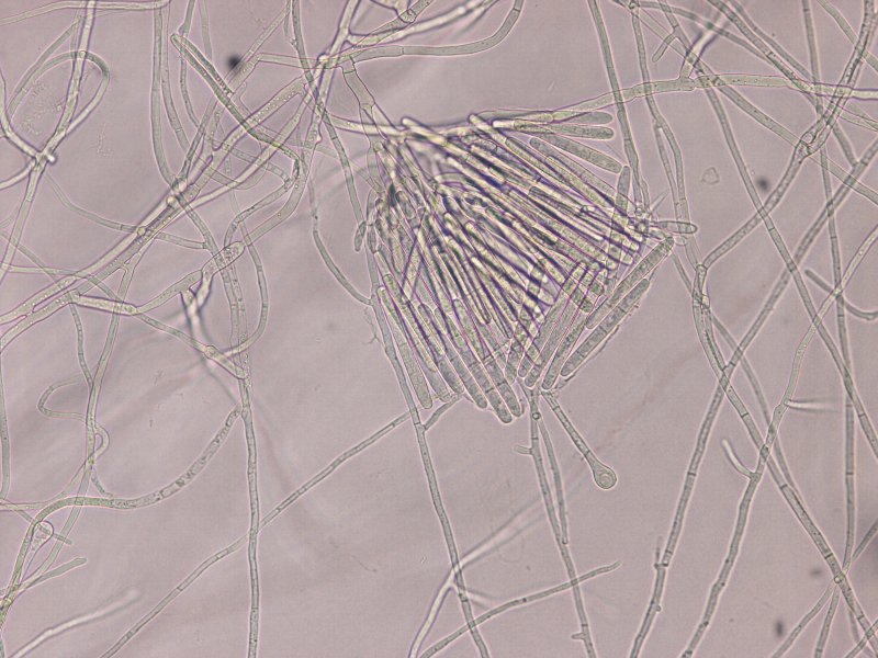 分生胞子とvesicle