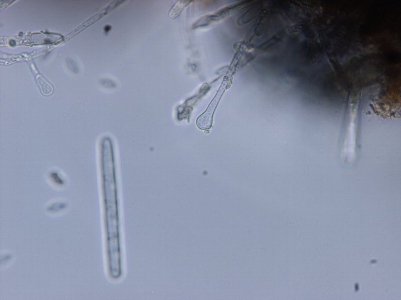 vesicleと分生胞子