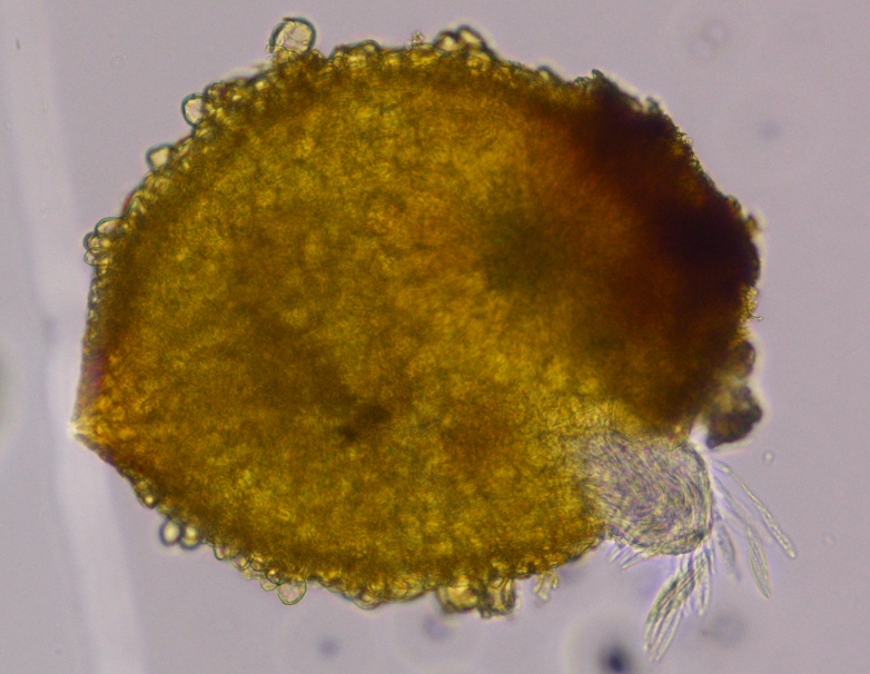 vesicleと分生胞子