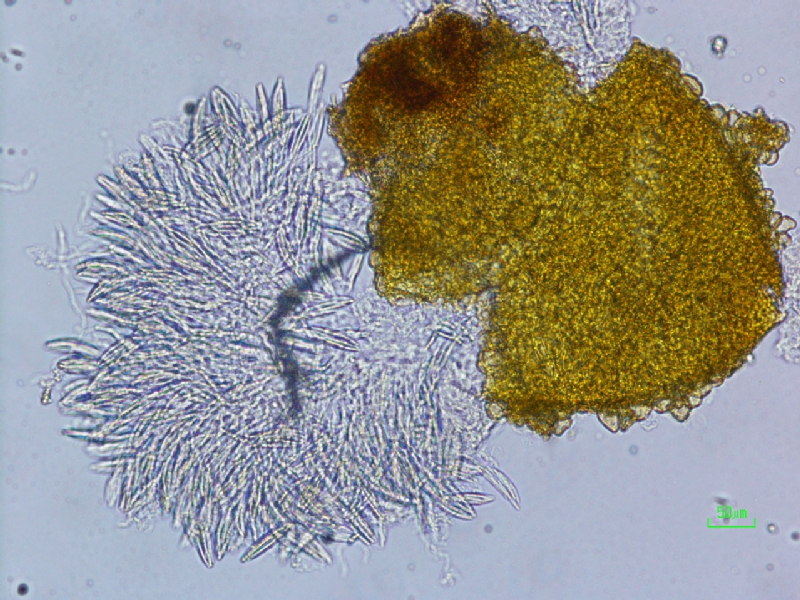 vesicleと分生胞子