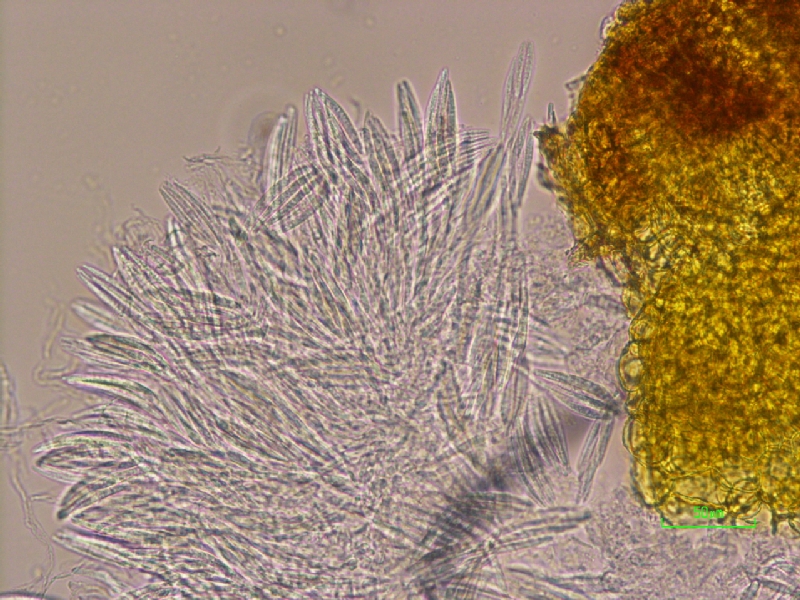 vesicleと分生胞子