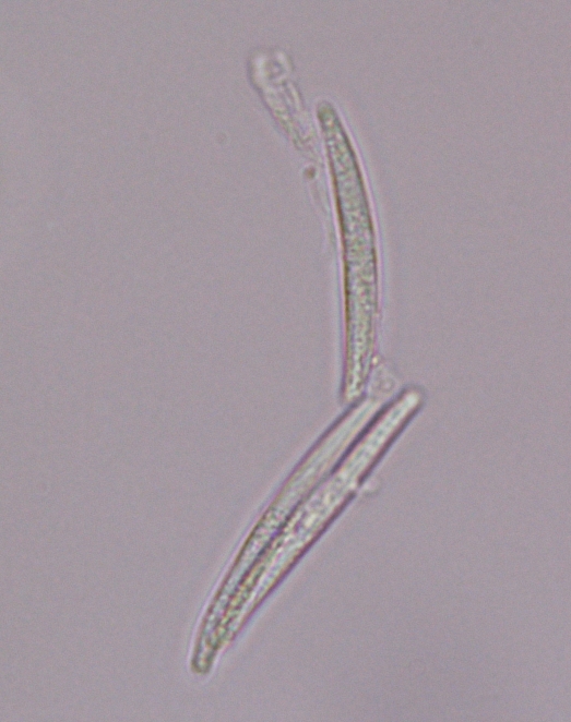 vesicleと分生胞子