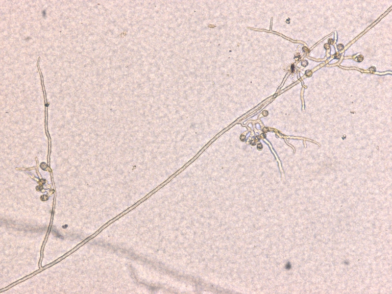 Pythium myriotylumの菌糸（隔壁なし。原形質流動がある）と付着器