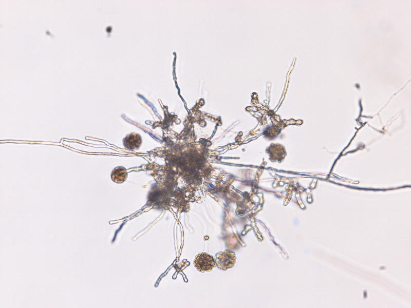 Pythium myriotylumの遊走子のうと球のう