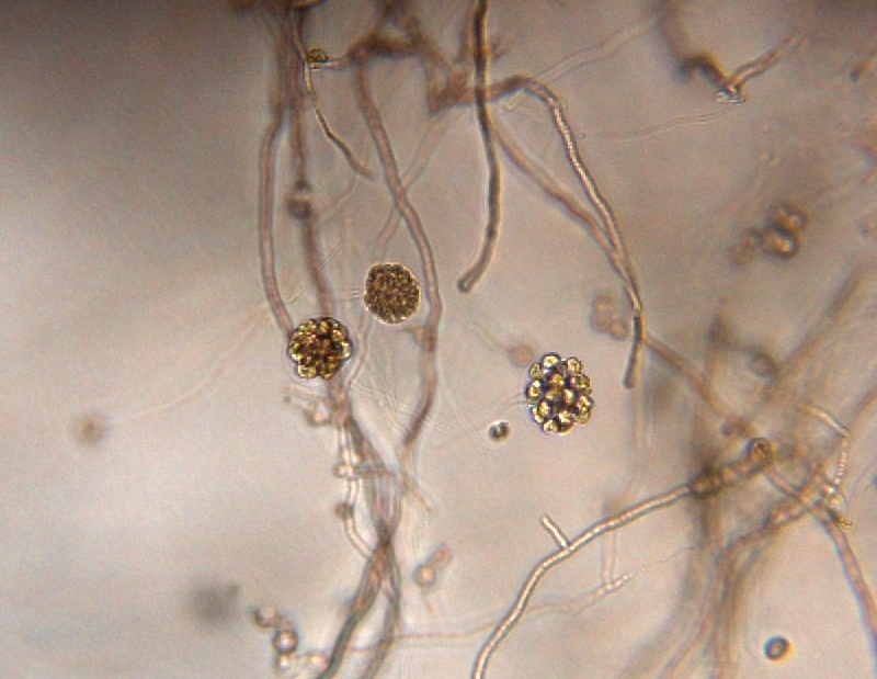 Pythium myriotylumの球のうと遊走子
