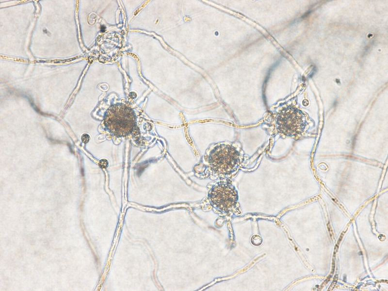 Pythium myriotylumの蔵卵器と蔵精器