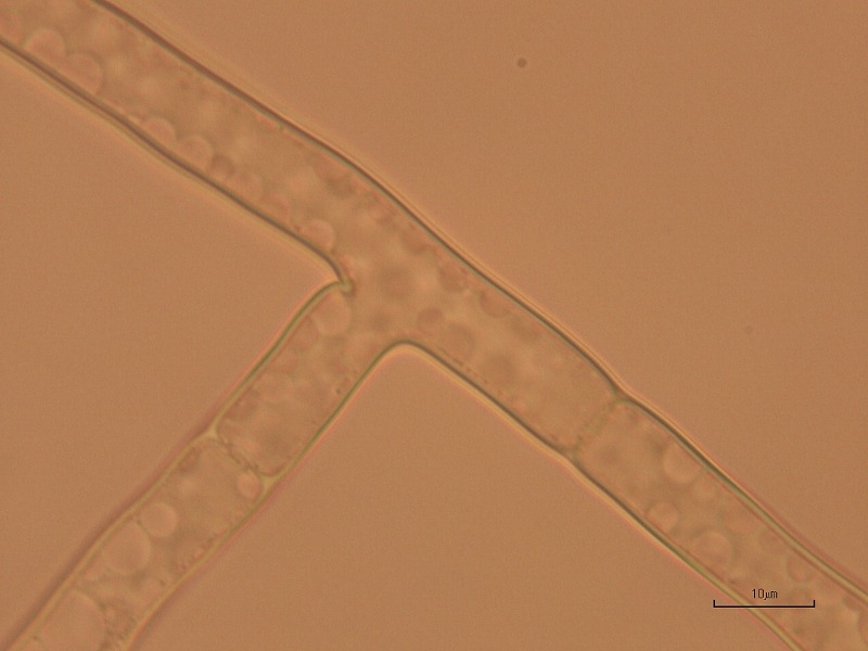 リゾクトニア根腐病病原1