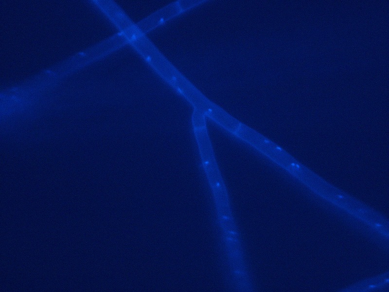 リゾクトニア根腐病病原2