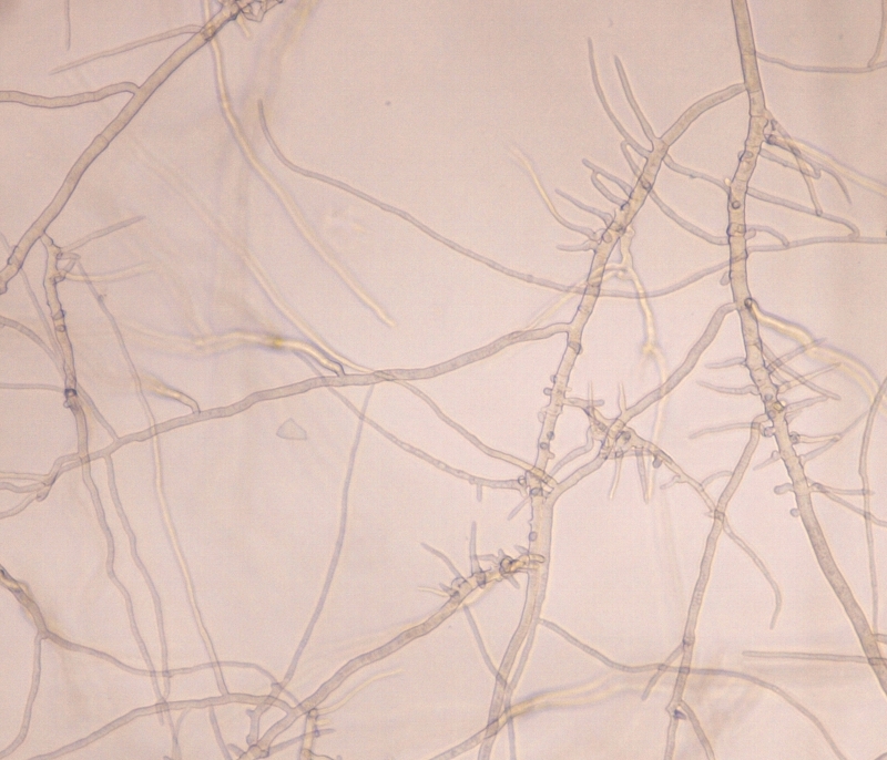 ダイズ炭腐病 病原5