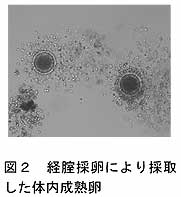 図2 経腟採卵により採取した体内成熟卵