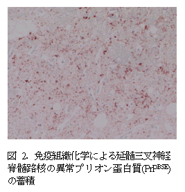 図2.免疫組織化学による延髄三叉神経 脊髄路核の異常プリオン蛋白質(PrPBSE) の蓄積