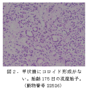 図2 . 甲状腺にコロイド形成がな い。胎齢175 日の流産胎子。