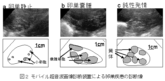 図2.モバイル超音波画像診断装置による卵巣疾患の診断像