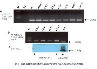 図1 抹消血単核球分画jからのBLVプロウィルスおよびmRNAの検出