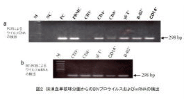 図2 末梢血単核球分画からのBIVプロウイルスおよびmRNAの検出