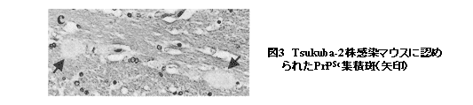 図3 tsukuba-2株感染マウスに認められたPrPsc集積斑