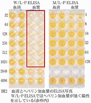 図2.血清とヘパリン加血漿のELISA写真W/L-P ELISAではヘパリン加血漿が強く陽性を示している