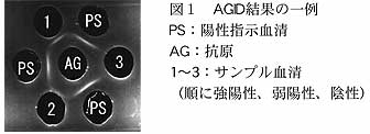 図1 AGID 結果の一例