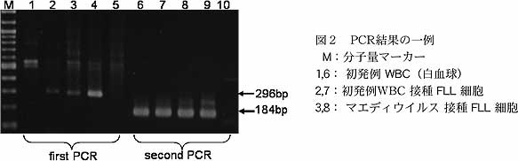 図2 PCR 結果の一例